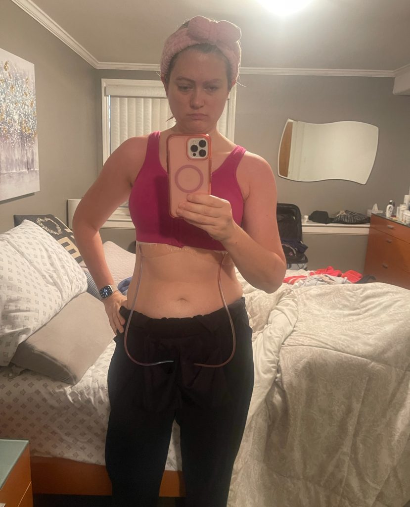 a women taking a mirror selfie wearing a pink compression bra and drains coming out of the bra